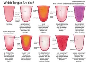 Tongue Syndromes